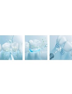 PANASONIC Pack de 2 Recambio Boquilla Irrigador Ultrasonica  WEW0982 x EW1611